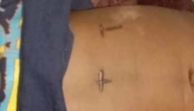 दर्दनाक : इलाज के लिए दो माह की मासूम बेटी के पेट पर दागे तीन बार गर्म सलाखें,अस्पताल में हुई मौत