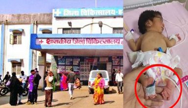 Madhya Pradesh: उल्टे पैर के साथ जन्मी बच्ची, माता-पिता ने अस्पताल में छोड़ा, डॉक्टर मान रहे दुर्लभ…