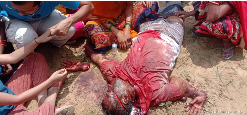 मरीज देख रहे डॉक्टर पर तलवार से हमला कर की गई हत्या, आरोपी ने पहले काटा हाथ फिर गर्दन और सिर पर किए कई वार