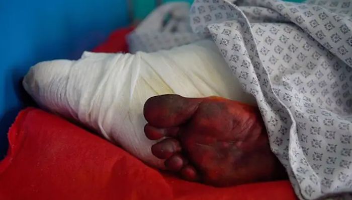 नेल पॉलिश लगाया तो ऊंगली काट दी, तालिबान की दिल दहला देने वाले कहानी…