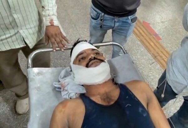 सीहोर: रास्ते के विवाद में युवक पर हमला, गंभीर हालत में भोपाल रेफर