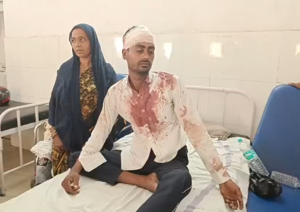 टमाटर के दाम को लेकर विवाद, पन्ना में मारपीट के बाद दोनों पक्षों पर मामला दर्ज